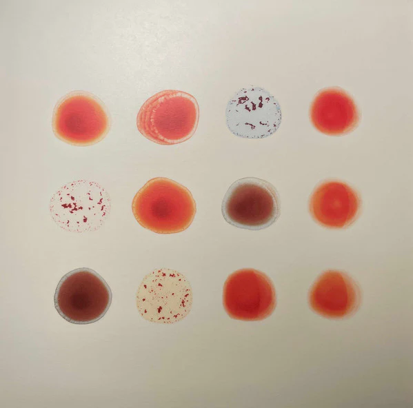 Peter Gabriel / Scratch My Back / And I'll Scratch Yours - LP, Album, RE + LP, Album + Comp (M/M) - Image 2